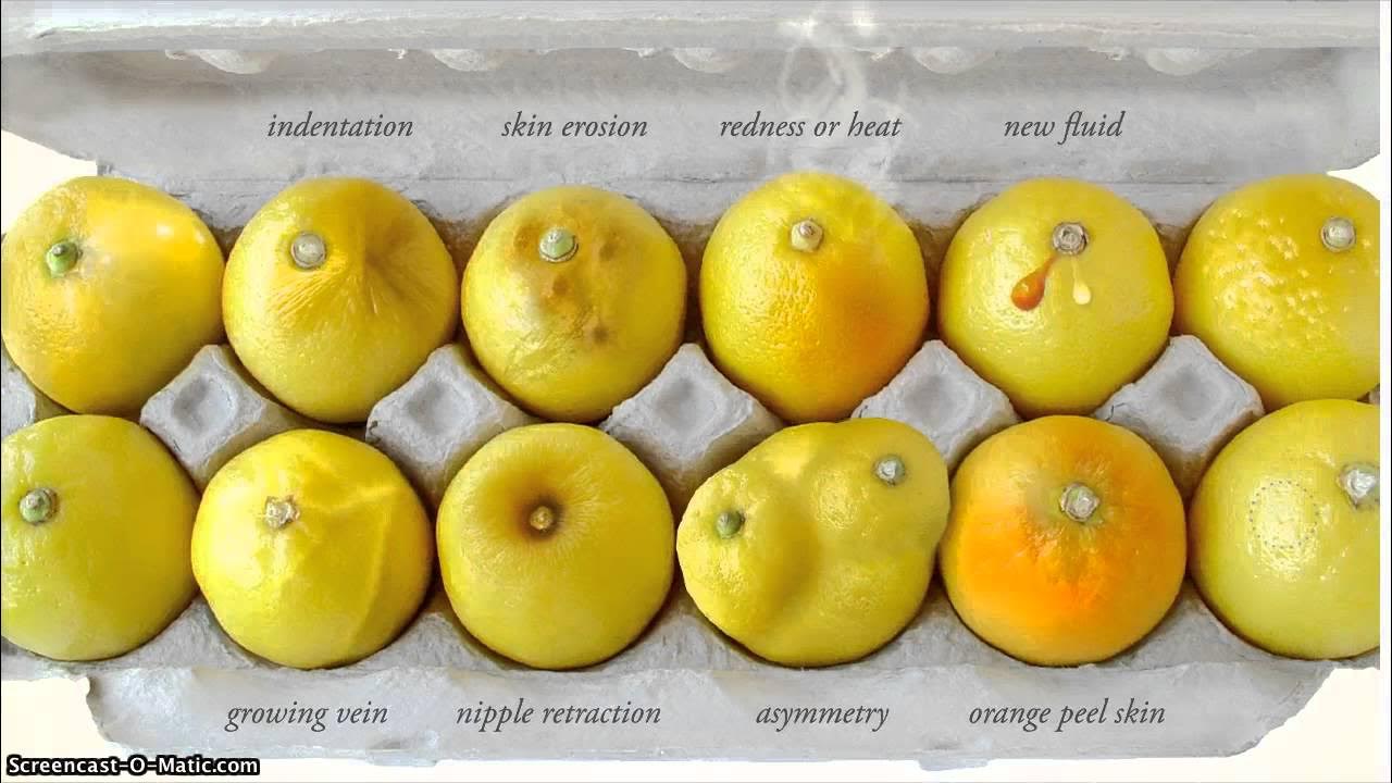 Рак груди апельсиновая корка как выглядит
