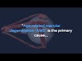 Aging-US | Age-related Macular Degeneration and C-reactive Protein