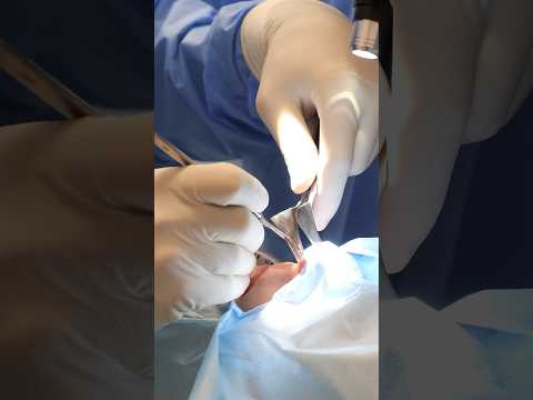 The Plastic Surgeon FINALLY in London | #skincare #beauty #londonbeauty