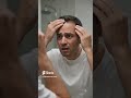 Why stopping hair loss requires early action