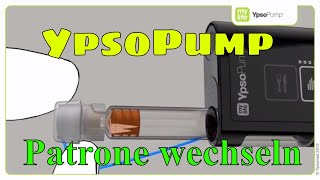 YpsoPump Patrone wechseln Insulinpumpe mylife Diabetescare 08 screenshot 1