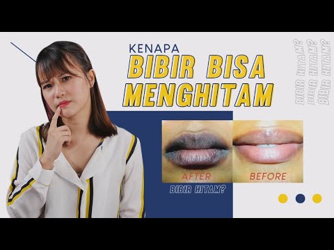 Video: Mengapa menjilat bibir itu buruk?