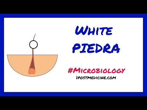 Video: White Piedra: Hva Det Er, Hvordan Du Får Det, Hvordan Det Blir Behandlet