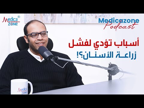 اسباب تؤدي لفشل زراعة الاسنان خطوات محدده دكتور محمد حمدي زراعة الاسنان