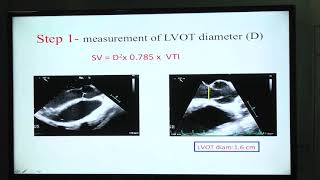 20180822_14_ Haemodynamic Calculations_ Debika_Chatterjee_Dr
