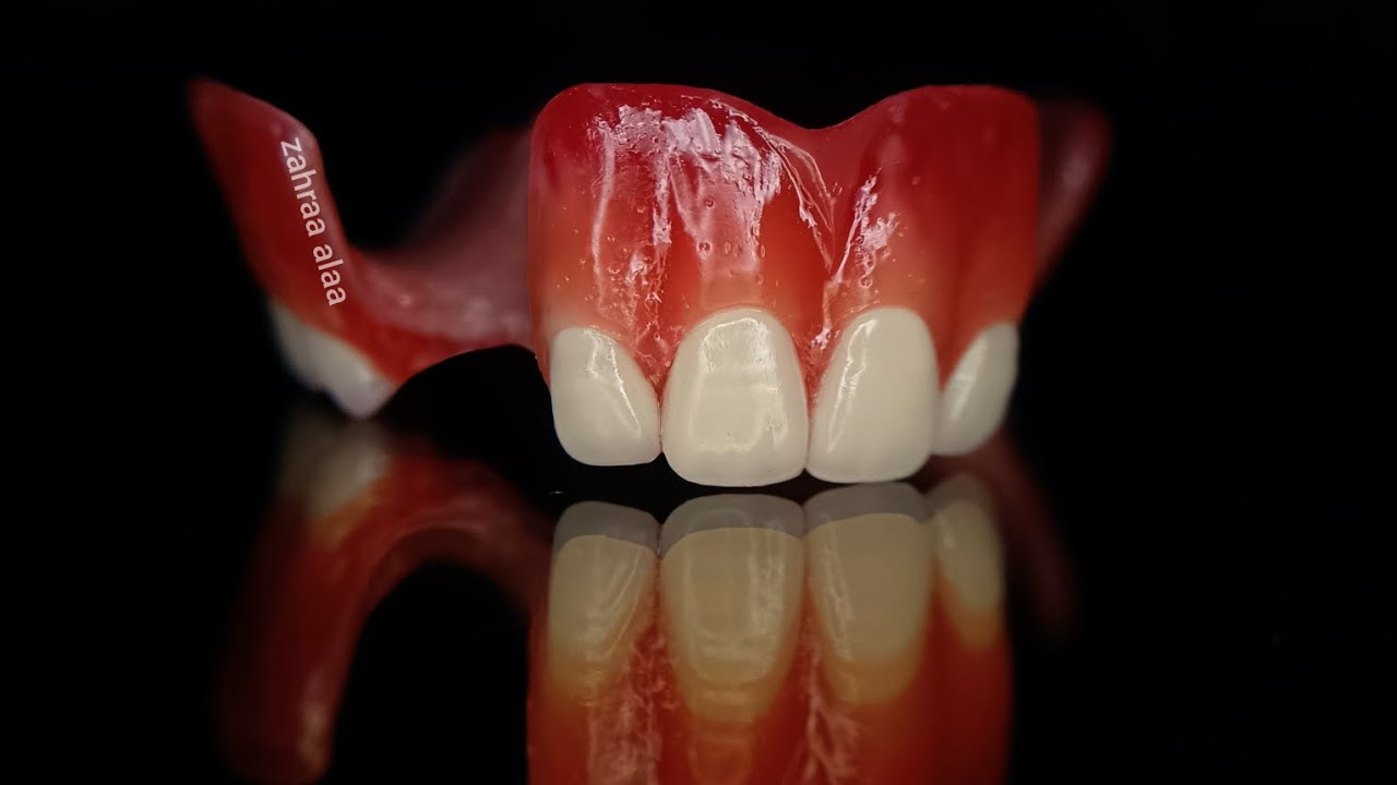 طب أسنان مرحلة ثالثة/ خطوة ترتيب الأسنان/ د. زهراء علاء