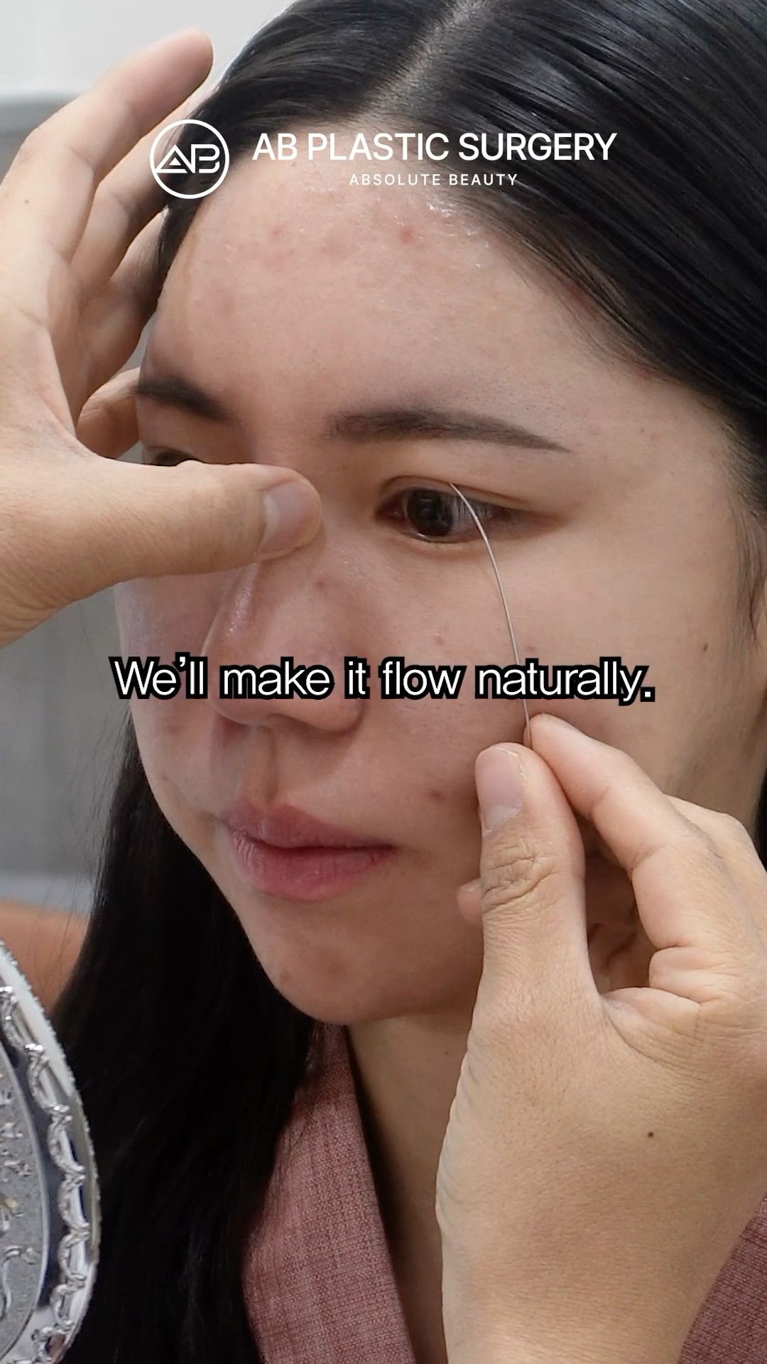 Double Eyelid Revision: Her Second Chance Begins #koreanplasticsurgery