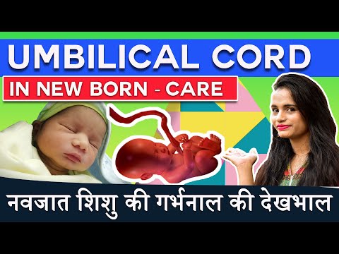 नवजात की गर्भनाल | Umbilical Cord Care| शिशु के (अम्बिलिकल स्टंप) की देखभाल |