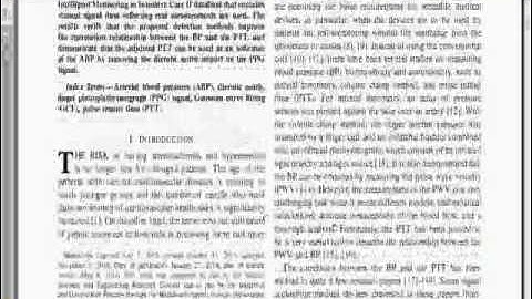 IEEE 2014 SIGNAL PROCESSING MATLAB  SECONDARY PEAK DETECTION OF PPG SIGNAL