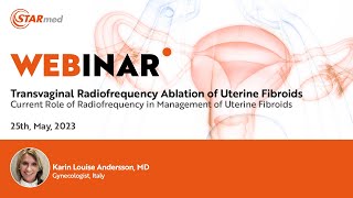 2023.05.25 Indications of Radiofrequency for the Treatment of Uterine Fibroids