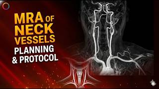 How to Perform MRA of Neck Vessels | Complete Guide for Beginners