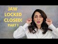 Jaw Locked Closed - Part 1 - Priya Mistry, DDS (the TMJ doc) #jawlockedclosed #lockjaw #jawpain