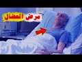 ما هو مرض العضال ما هو مرض العضال