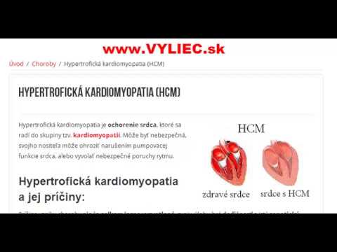 Video: Hypertrofická Kardiomyopatia (HCM) U Mačiek Ochorenie Srdca U Mačiek