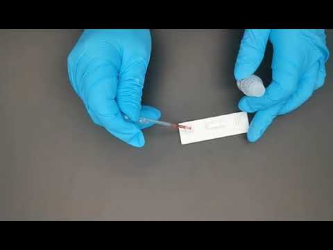 Video: Testul De Isozimă Osoasă ALP: Scop, Procedură și Rezultate