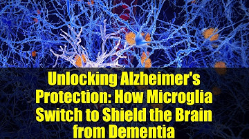 Unlocking Alzheimer