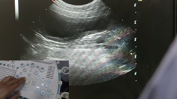 Optimising your ultrasound image
