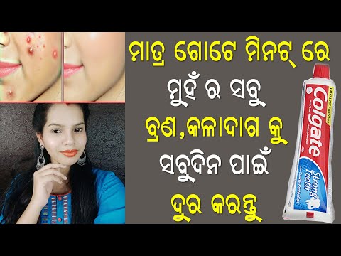 How To Remove Pimples & Dark Spot Permanently | Get Rid Of Pimples Naturally| Priyanka’s Tips