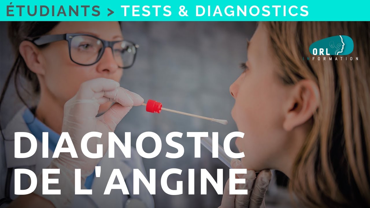 Comment réaliser un Test de Détection Rapide de l'angine (TDR)