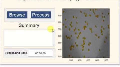 Classification and Counting of Lentils in MATLAB