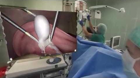 Highly-Immersive Virtual Reality Laparoscopy Simulation