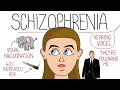 Schizophrenia explained includes dsm5 criteria  delusion examples