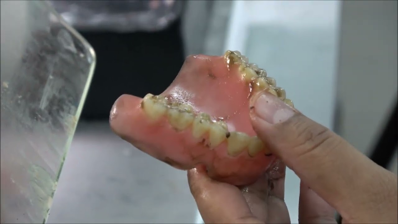 COMPLETE DENTURE 18Trimming & Polishing YouTube