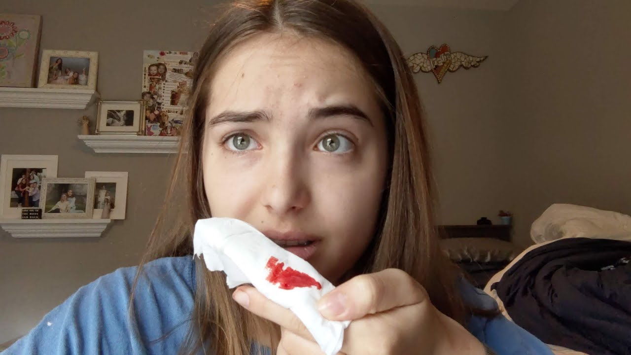 Another Vlog: I got a nose bleed?!