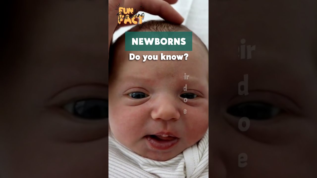 The Skull Bones In Soft Spots Haven T Yet Grown Together Newborns Parentingfunfact Trending