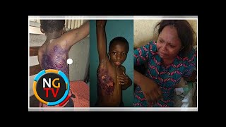Housewife burns maid with hot water for sleeping on her couch (Photos)