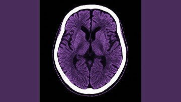 Internal Dissonant Phase