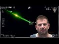 Police Hit With Laser Strikes ( Disaster Waiting to Happen)