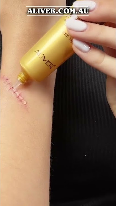 Aliver TCM Scar Removal Gel Cream