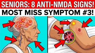 SENIORS: 8 Anti-NMDA Receptor Encephalitis Signs (Most Miss #3)