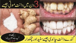 Magical Teeth Whitening Remedy | Get Whiten Teeth in Just 5 Minutes | Sach tv