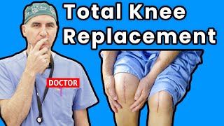 Life at Home After Total Knee Replacement: Essential Recovery Guide