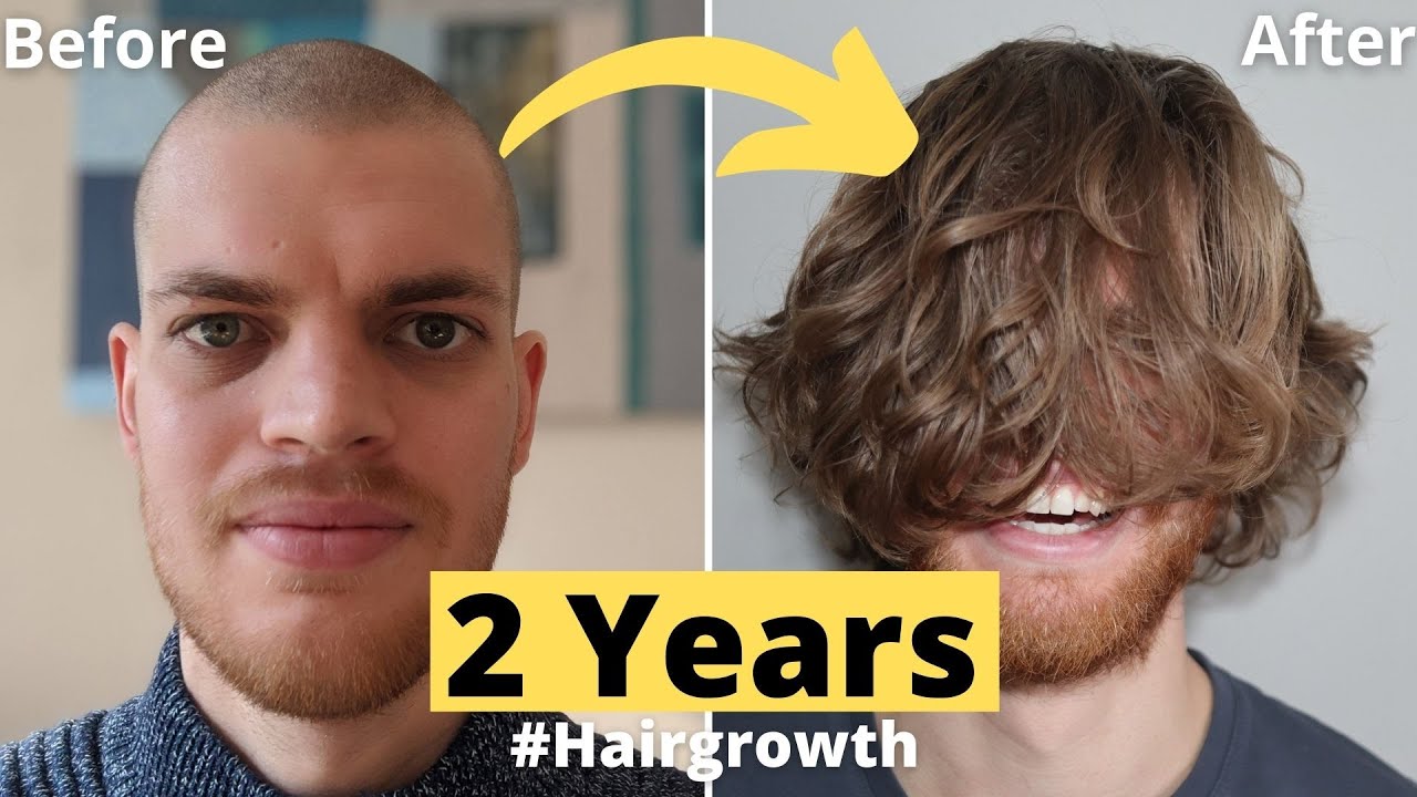 💇🏻💈Hair Growth Time Lapse 2 Years (24 Months) Men - From Buzz Cut -  YouTube