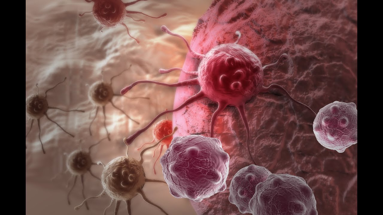 Рак.Онкология.Факты о заболевании.Причины и последствия болезни. - YouTube