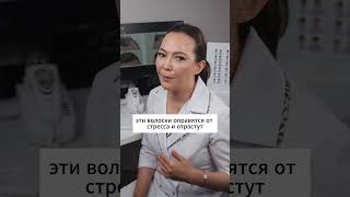 Пересадка волос Григория Лепса #пересадкаволос #пересадкаволосуфа #трихолог
