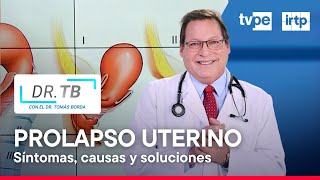 Prolapso uterino: causas, síntomas y tratamiento - YouTube