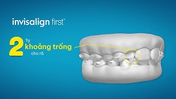 Invisalign First - Cho trẻ từ 6 đến 10 tuổi