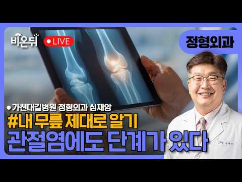 [내 무릎 제대로 알기 (6)] - 관절염에도 단계가 있다 / 가천대 <strong>길병원</strong> 정형외과 심재앙