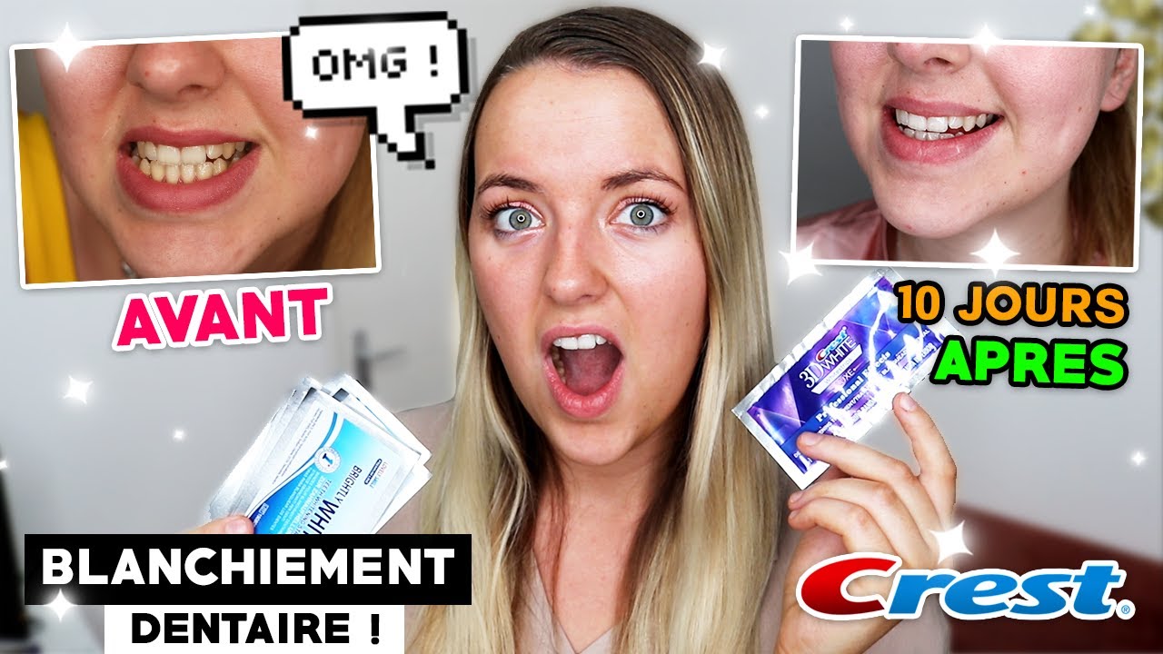 J'AI TESTÉ le BLANCHIMENT DENTAIRE ! Arnaque ou Pas ? AVANT vs. APRES (TEST MYCREST) !