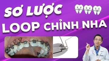 Sơ Lược Về Loop Chỉnh Nha | "V.ũ K.h.í Bí Mật" Kéo Khoảng Niềng Răng