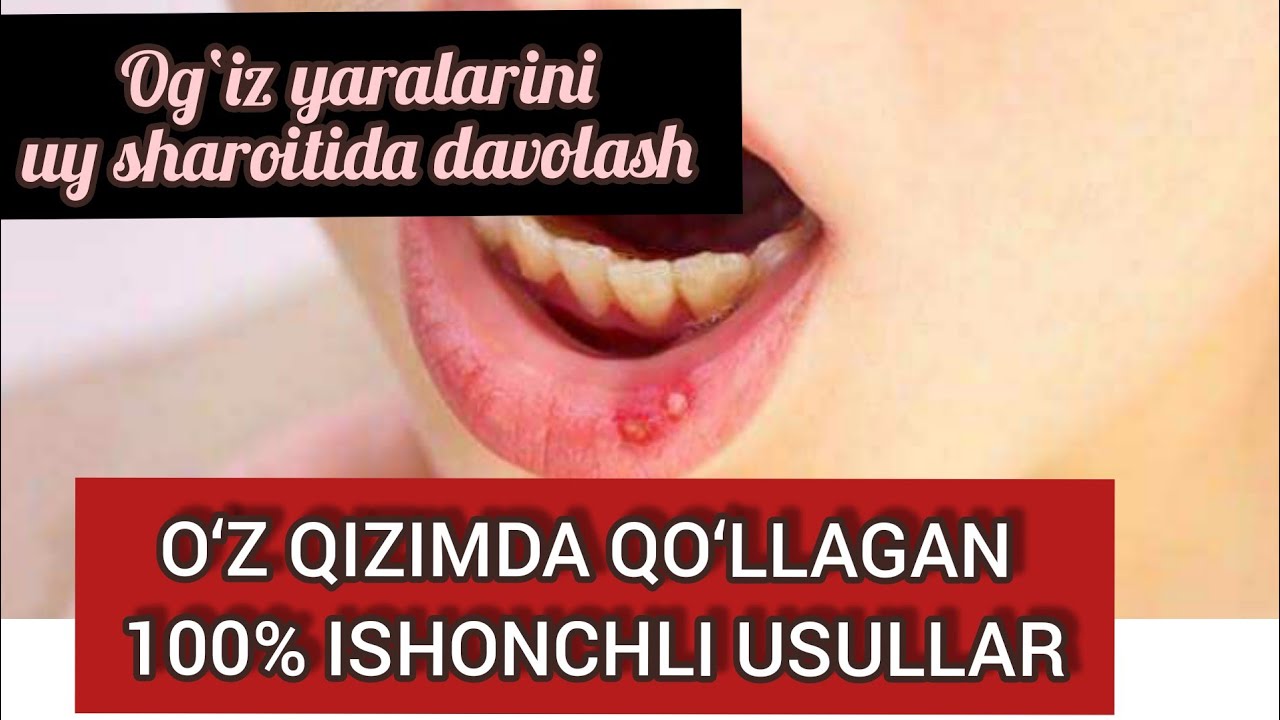 Язвочка Во Рту Фукорцин – Telegraph