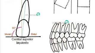 Las 6 llaves de la oclusión normal