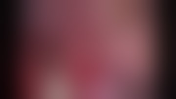 Asvide: Uniportal VATS right upper lobectomy and systemic mediastinal lymph nodes dissection