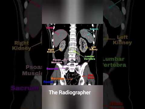 Abdomen Anatomy | Easiest way to Learn | #radiography #anatomy #Abdomen #ct #xrays #ctscan