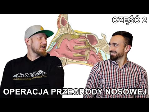 Wideo: Czy potrzebujesz przegrody?