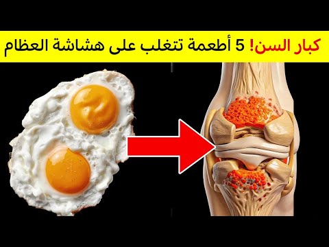 5 اطعمة رخيصة الثمن ستتغلب على هشاشة العظام لدى كبار السن